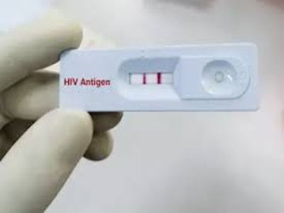 HIV Testing